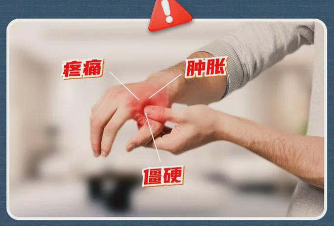 、手麻、腱鞘问题用它轻松搞定！必一运动小米生态杀疯了！手酸(图10)